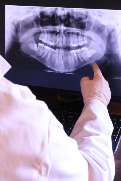 Best Emergency Dental Care for Broken or Chipped Teeth in San Carlos, TX