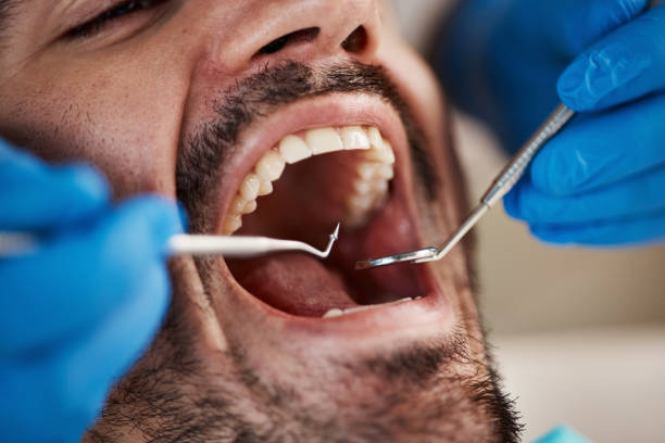Best Cosmetic Emergency Dentistry in San Carlos, TX
